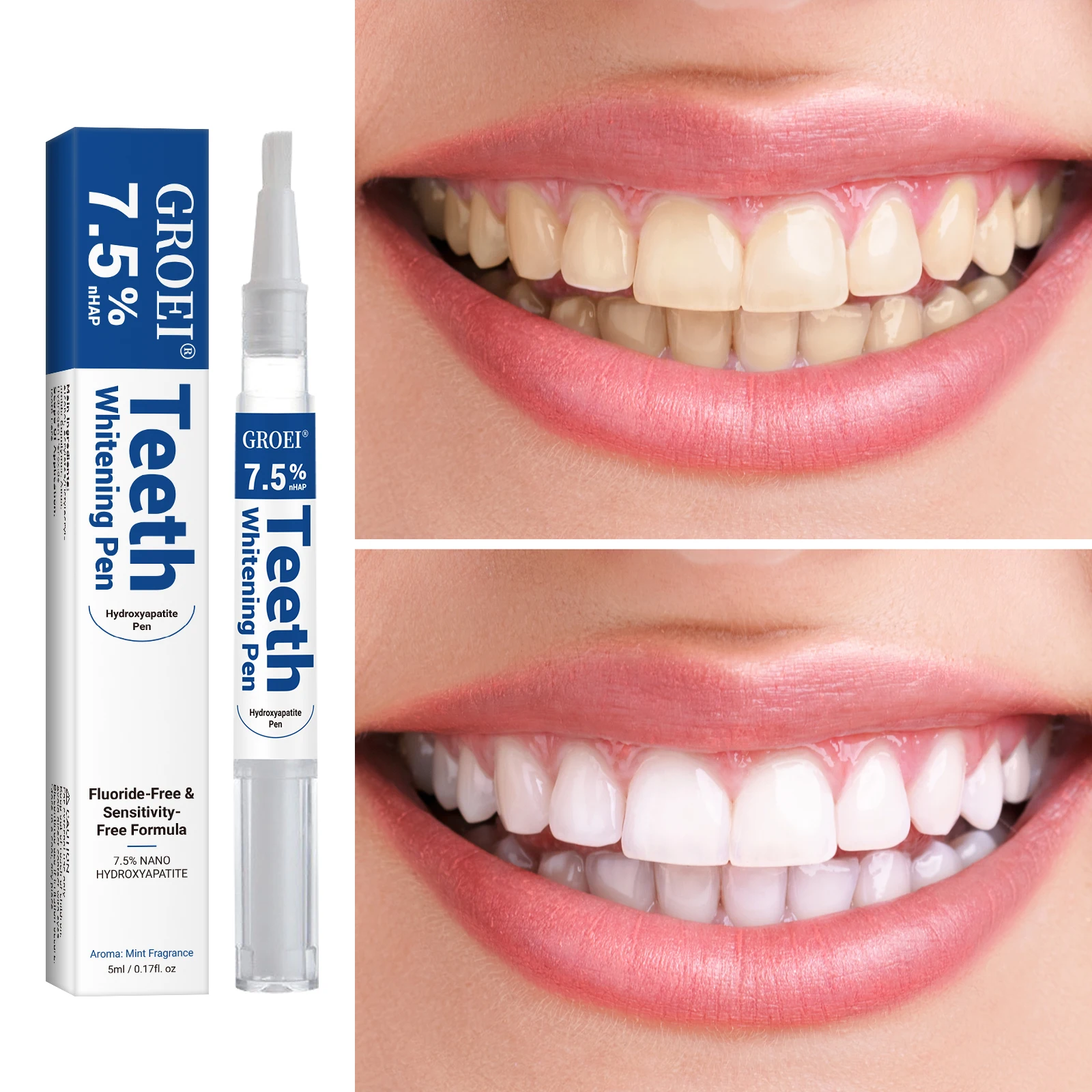 Hydroxyapatite Tooth Whitening - Teeth Whitening Singapore 리뷰 및 가격