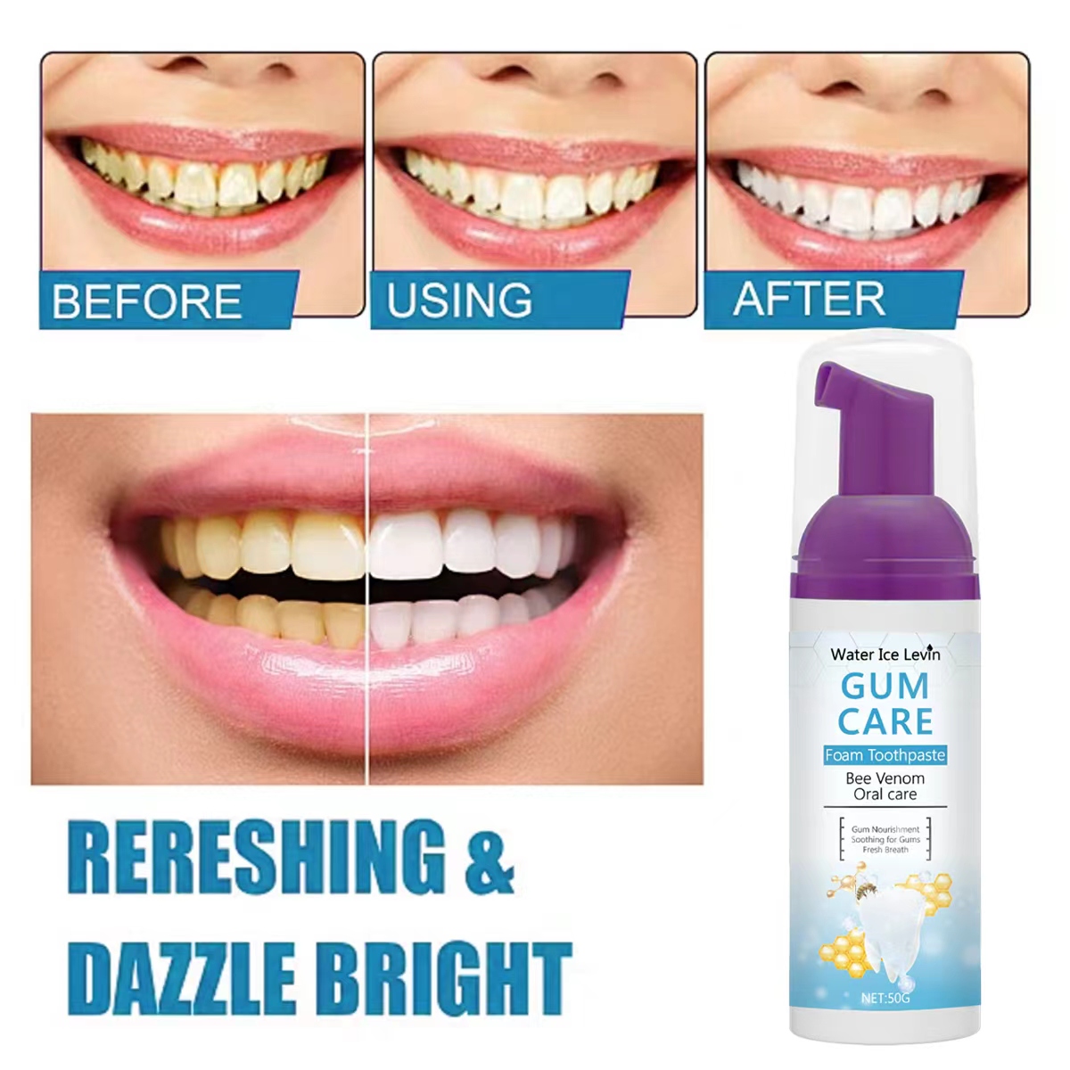 Water Ice Levin Gum Care Foam  - Teeth Whitening Xylitol Gum 리뷰 및 가격