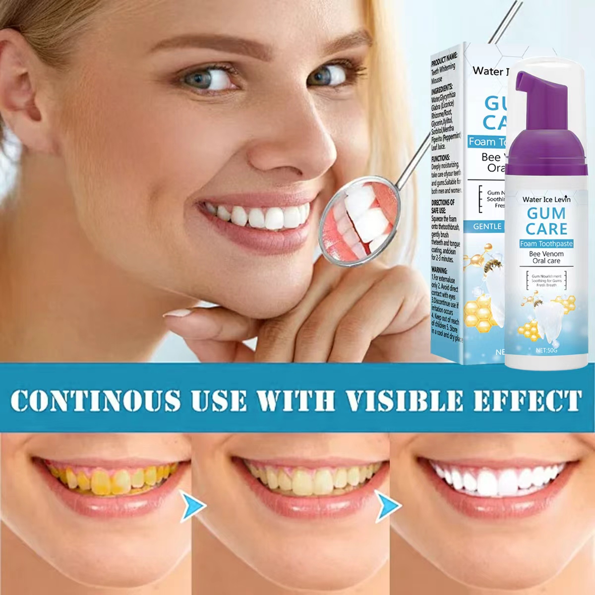 Water Ice Levin Gum Care Foam  - Teeth Whitening Xylitol Gum 리뷰 및 가격