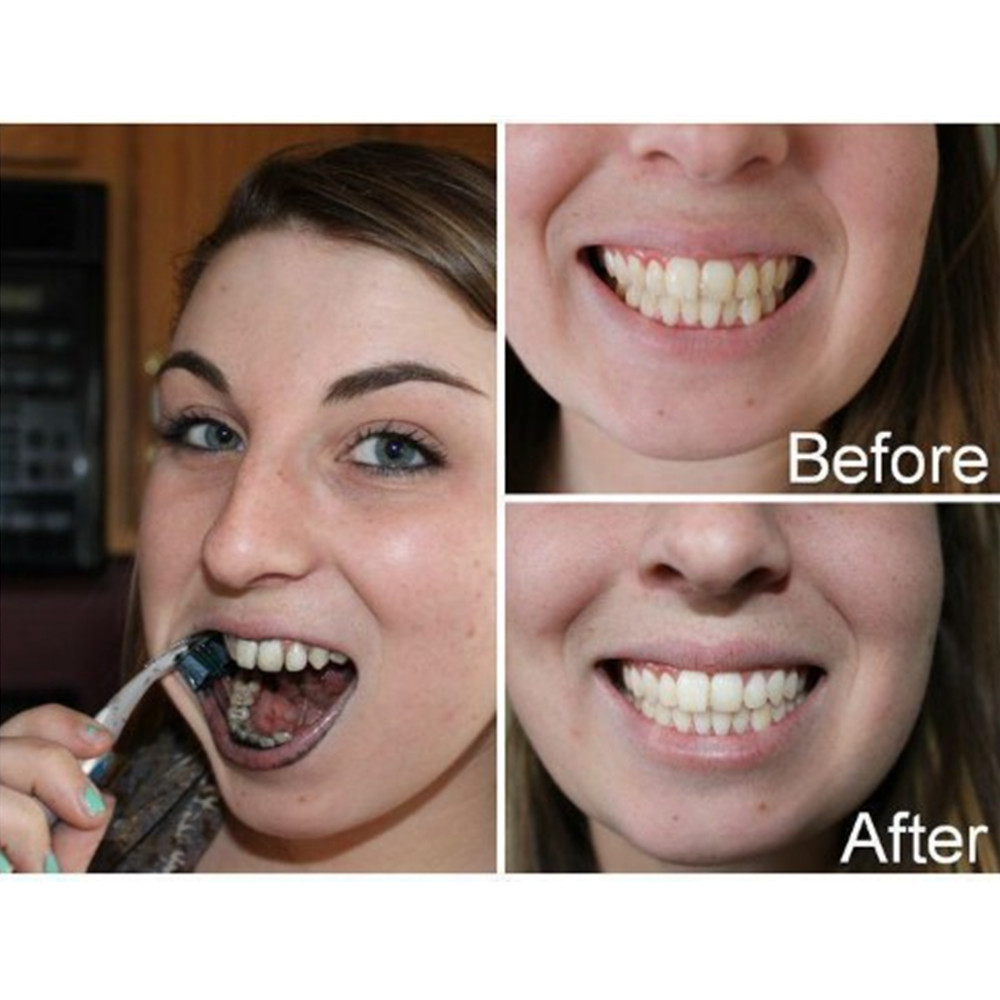 Bamboo Charcoal Teeth Tooth De - Teeth Whitening Singapore 리뷰 및 가격