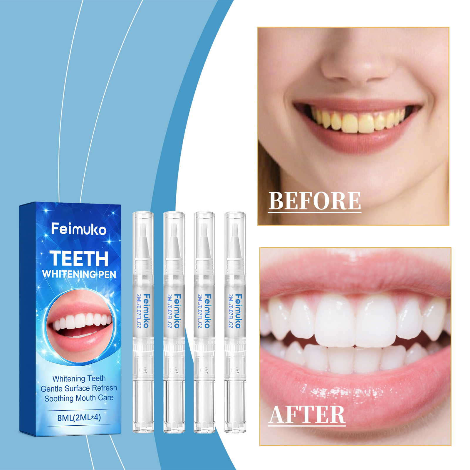 Feimuko 8ml Teeth Gel Pen Gent - Teeth Whitening Singapore 리뷰 및 가격
