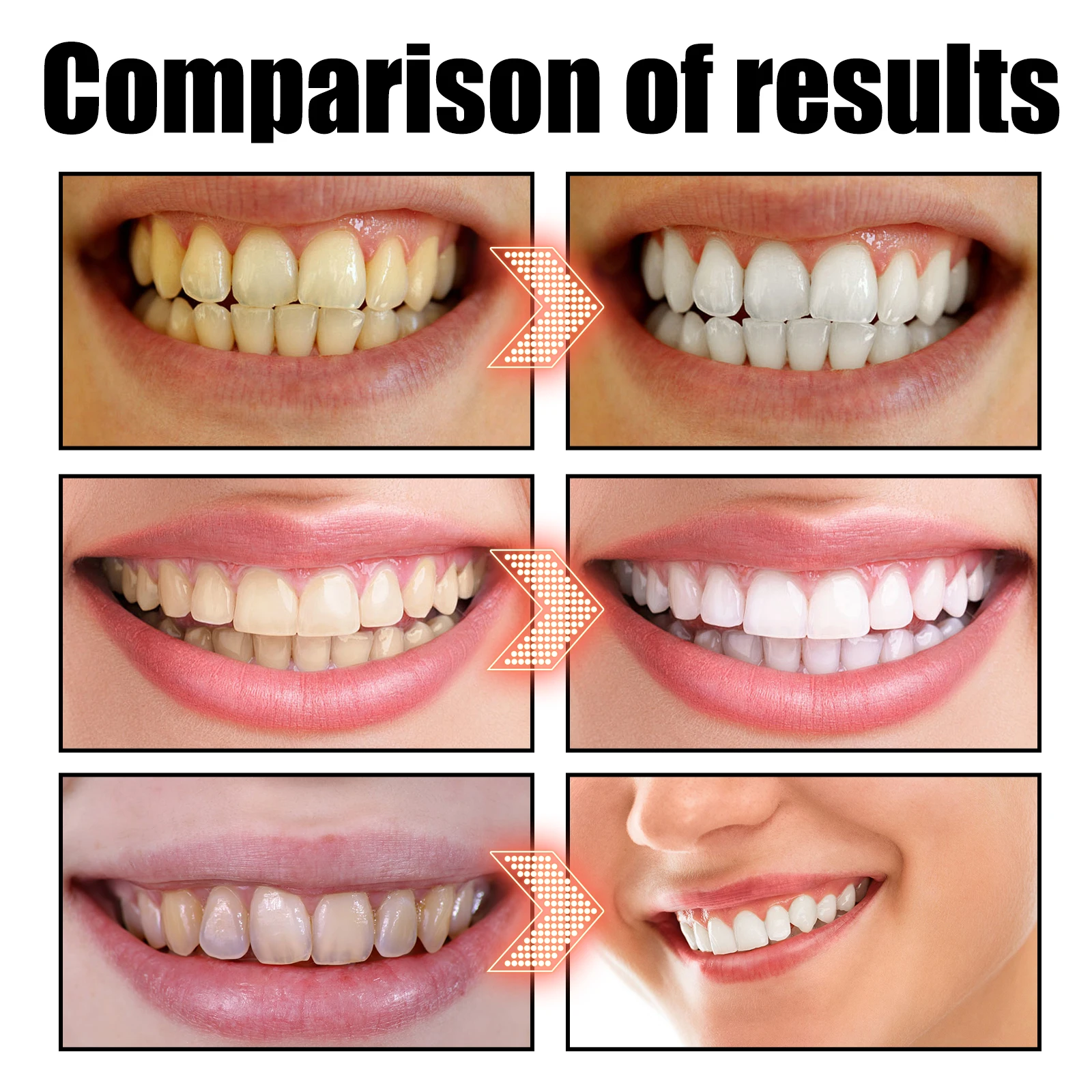 Coconut Mint Pulling Oil Mouth - Teeth Whitening Oil Pulling 리뷰 및 가격