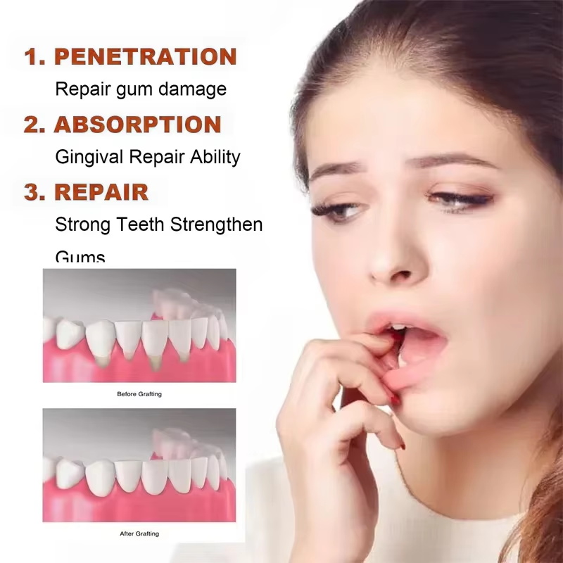 Rapid Soothing Gums Serum Effe - Teeth Whitening Thailand 리뷰 및 가격