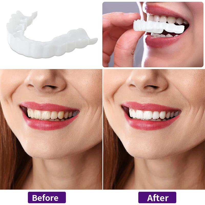 New Color Matching Natural Tee - Teeth Whitening Options 리뷰 및 가격