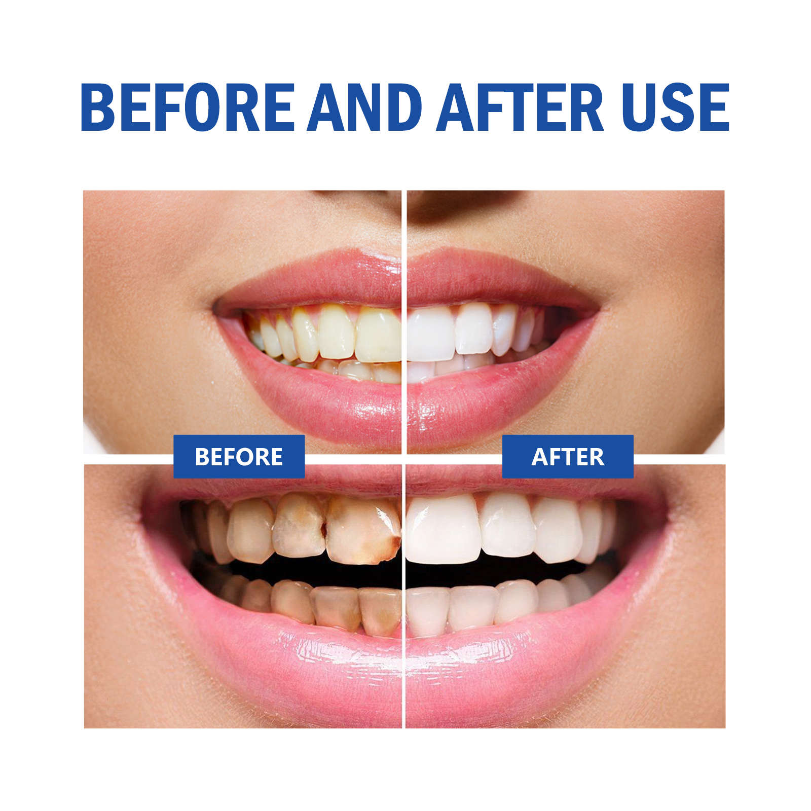Teeth Whitening Powder Remove  - Teeth Whitening Xylitol Gum 리뷰 및 가격