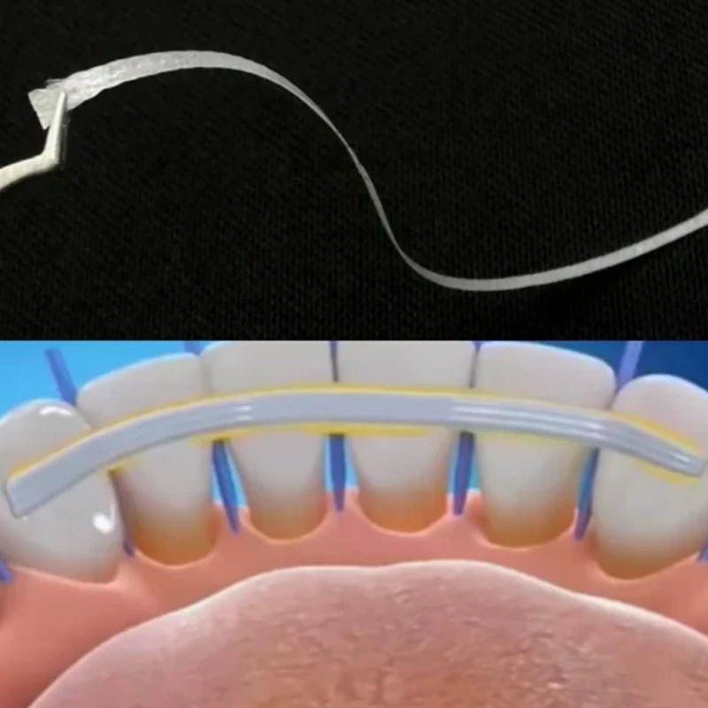 1Pc Dental Flexible Fiber Stri - Teeth Whitening Strips Lumineux 리뷰 및 가격