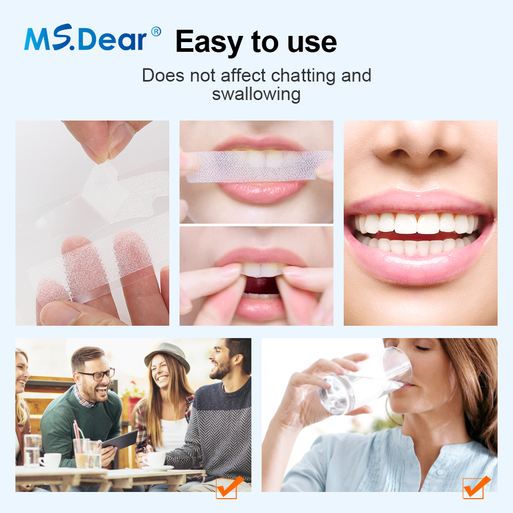 Teeth Whitening Strips Cleansi - Teeth Whitening Singapore 리뷰 및 가격
